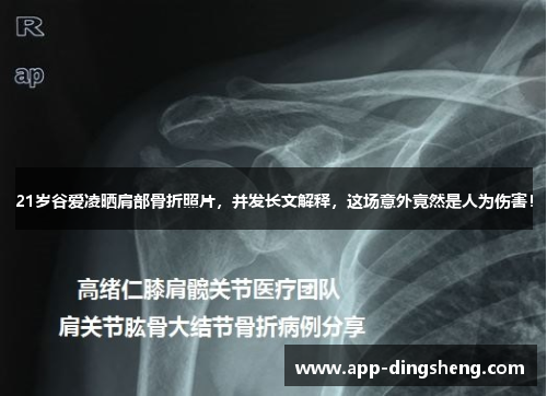 21岁谷爱凌晒肩部骨折照片,并发长文解释,这场意外竟然是人为伤害! 21岁谷爱凌晒肩部骨折照片,并发长文解释,这场意外竟然是人为伤害!